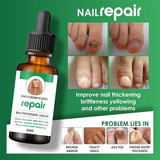 Natural Profesional Serum For Nail